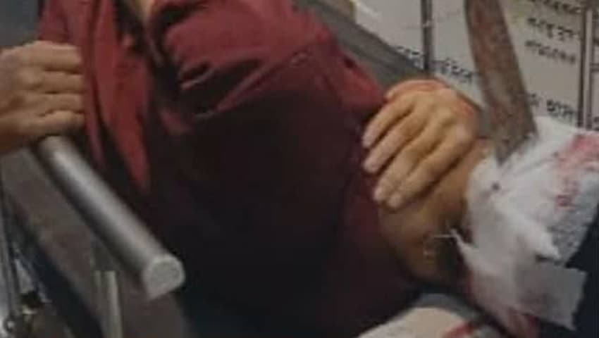 জাবিতে মর্মান্তিক দুর্ঘটনা: ঘাস কাটার ব্লেড ঢুকে যুবকের মাথায়, কর্তৃপক্ষের অনুমতি বিতর্ক